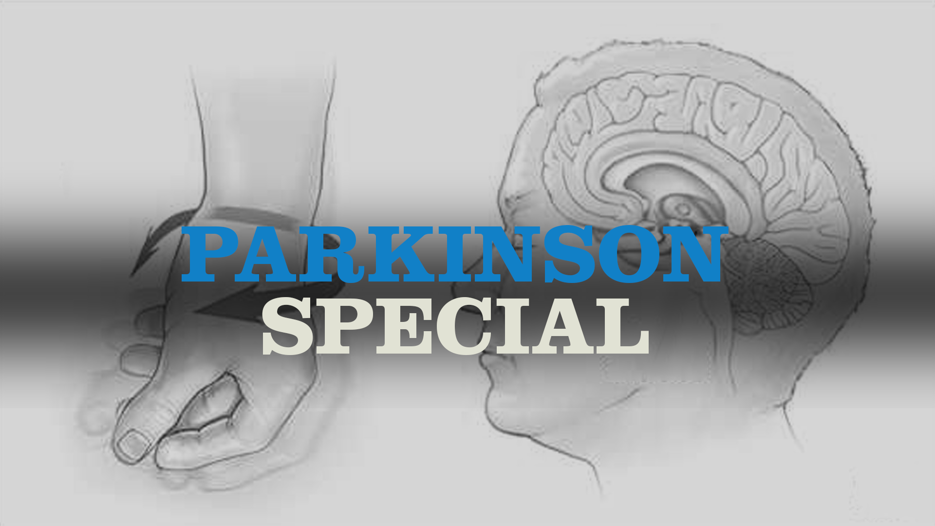 parkinson